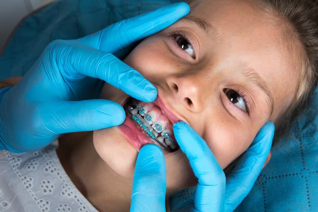 Pediatric Dentist Oakland